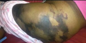 Natural Remedies to Relieve Diabetes in 2025