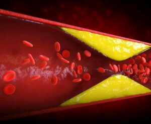 Natural Remedies to Relieve Diabetes in 2025